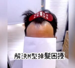 尋找理想的男士髮型解決方案？嘗試男生M型假髮補髮！